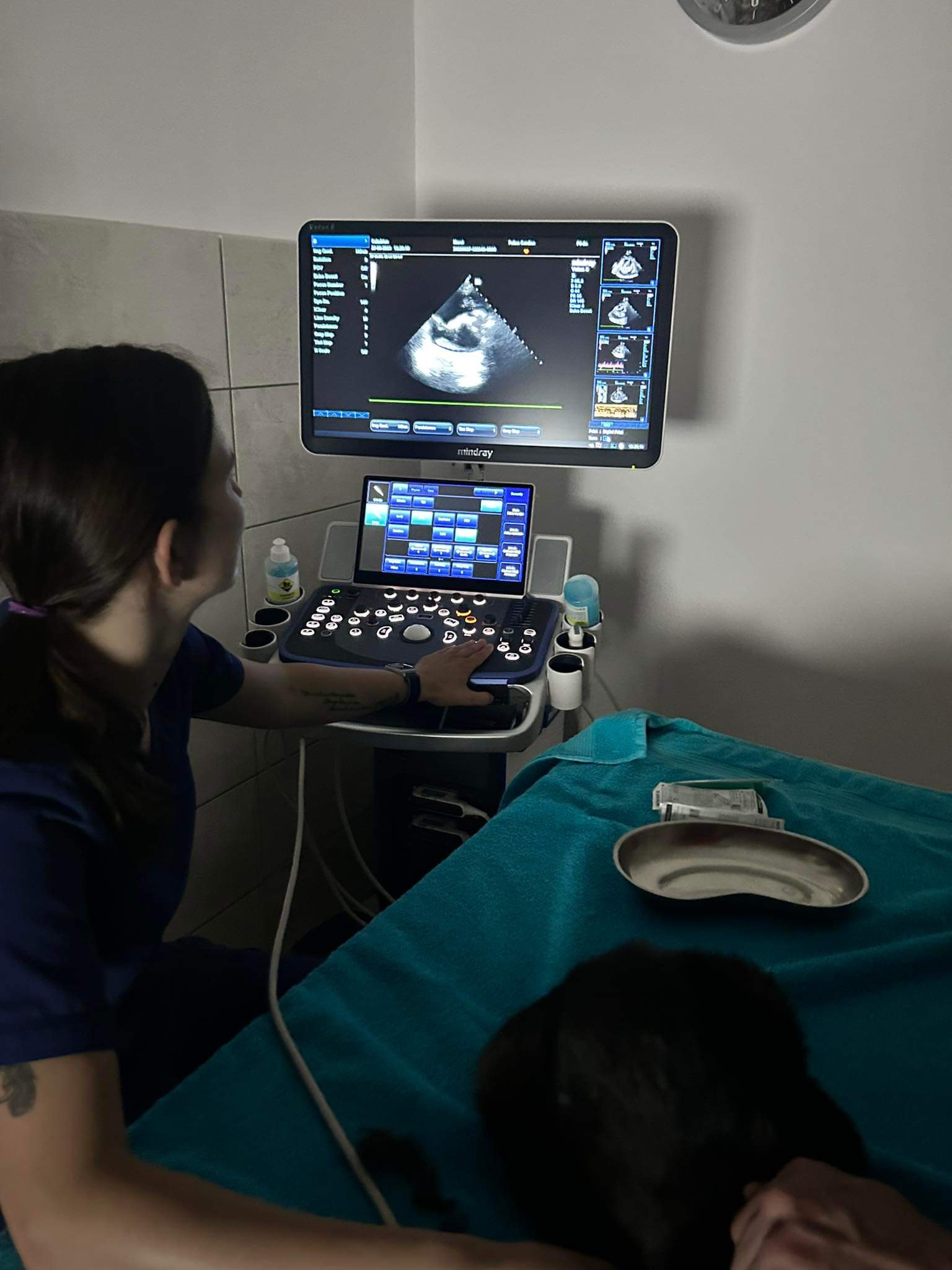 Ultrasound diagnostics